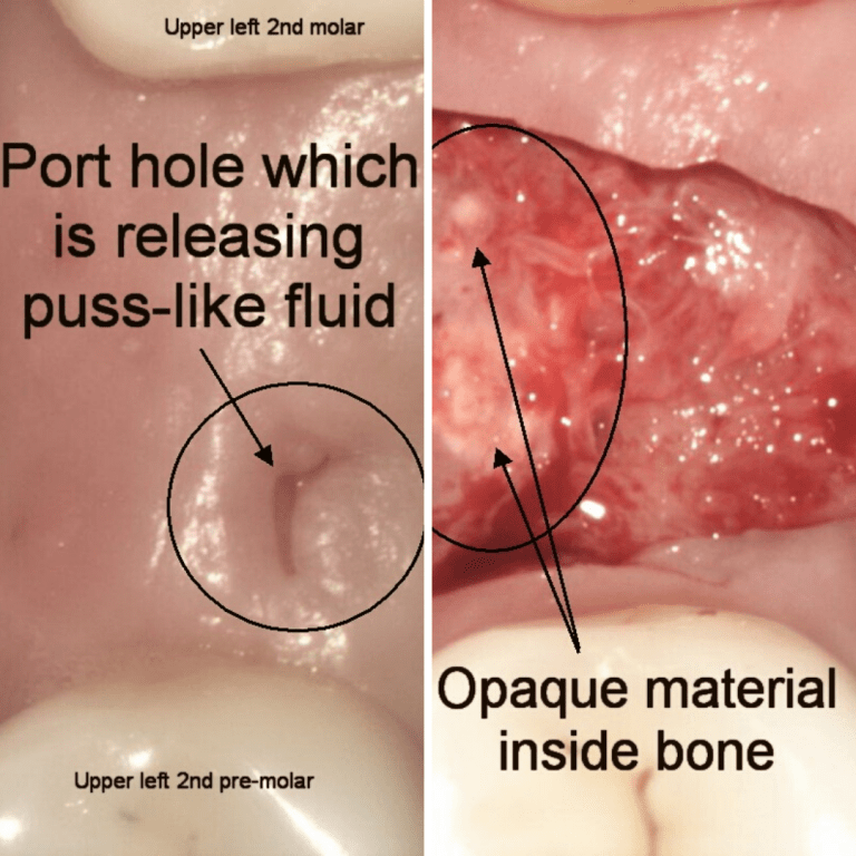 Element-5-image-768x768