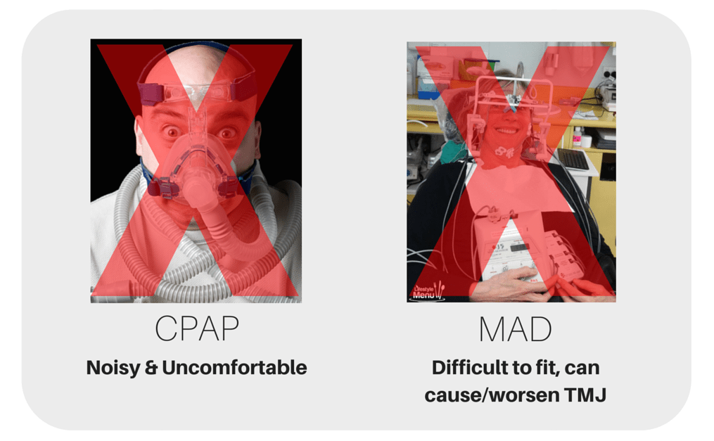 CPAP for Sleep Apnea CPAP and MAD treatment