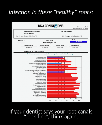 Root Canal Toxicity Report