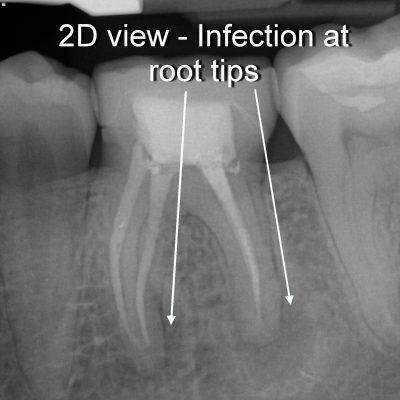 story-8-image-1-400x400