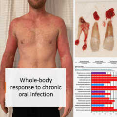 IMG_7550 Dental Mercury and Alzheimer's Disease