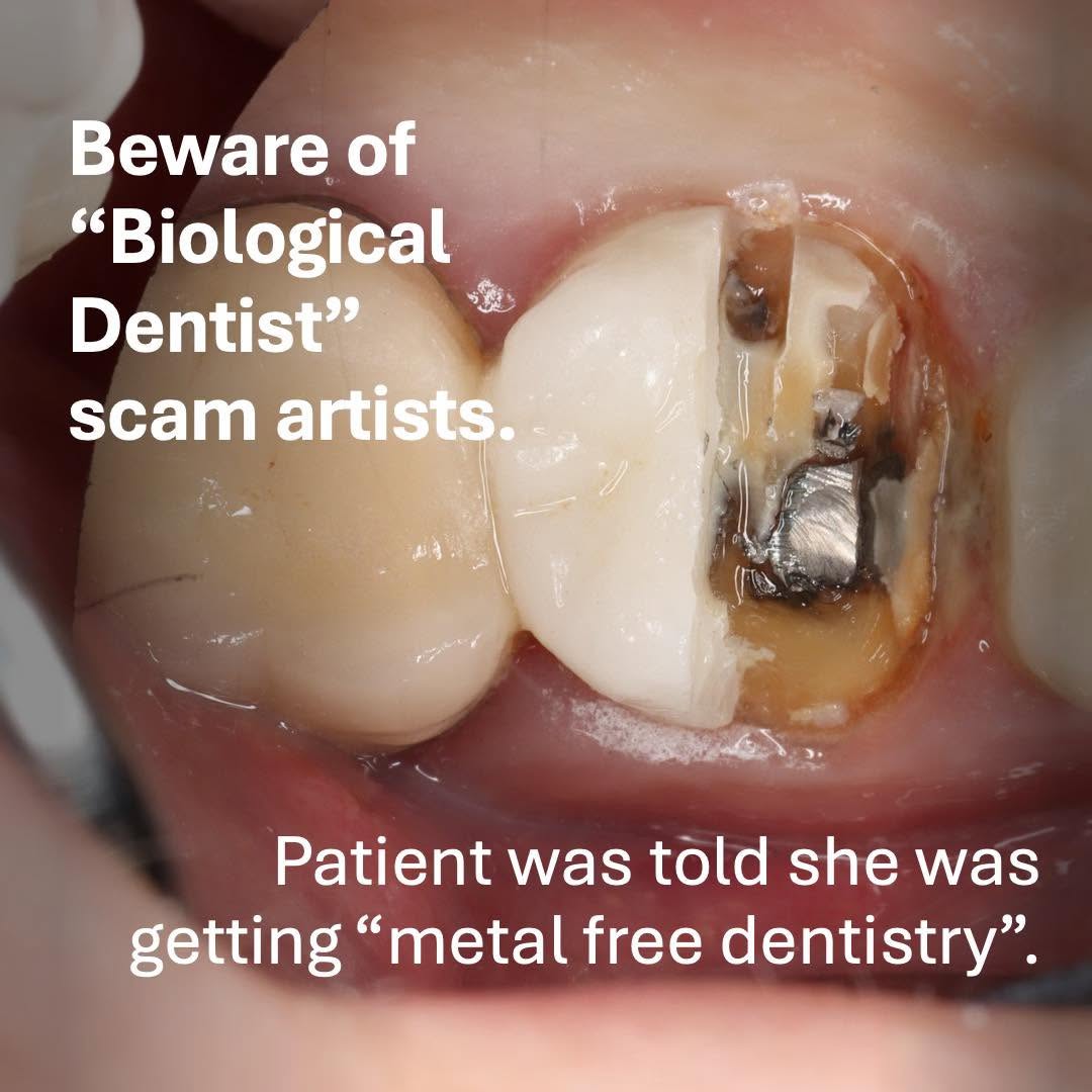 biological-1 beware of Biological Dentist scams