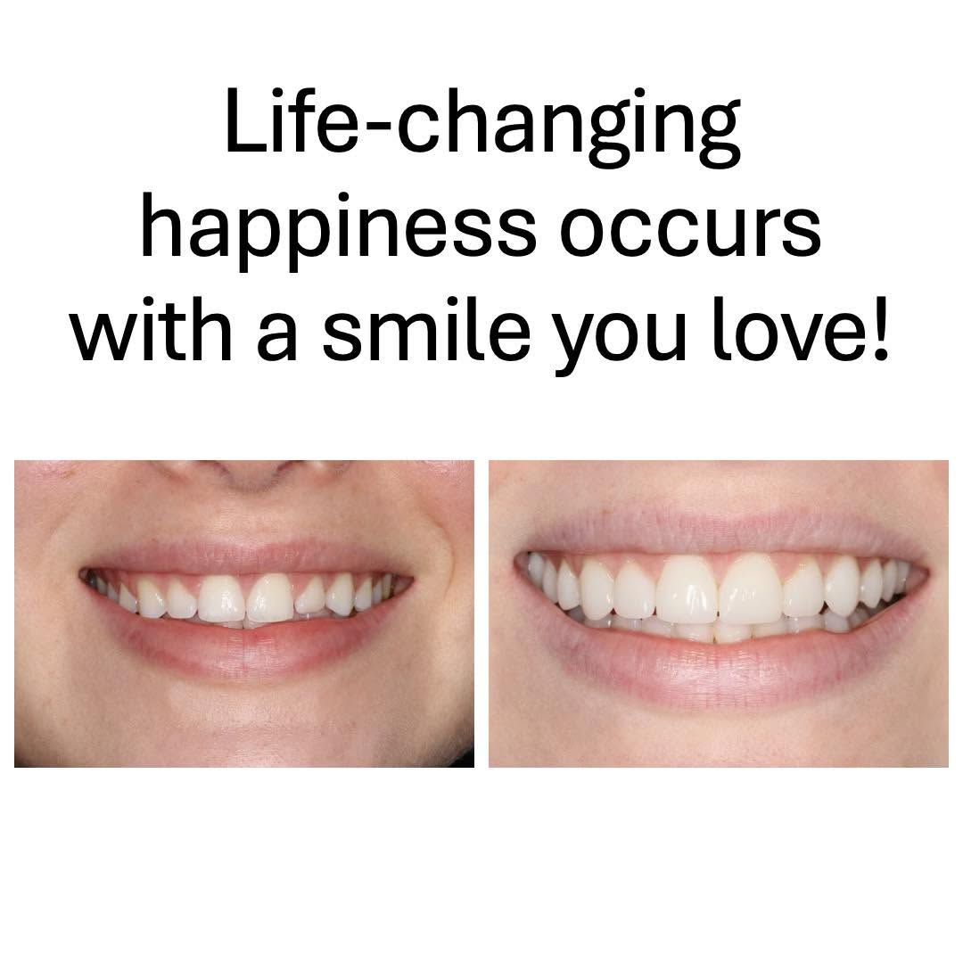life-changing-happiness Love your smile